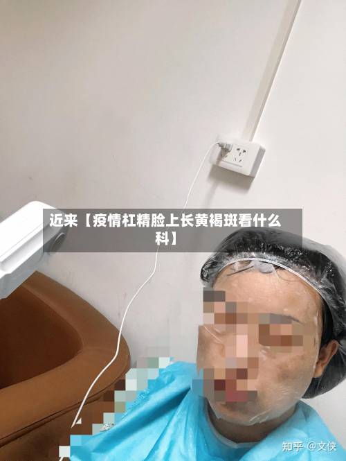 近来【疫情杠精脸上长黄褐斑看什么科】-第2张图片