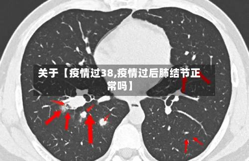 关于【疫情过38,疫情过后肺结节正常吗】-第3张图片
