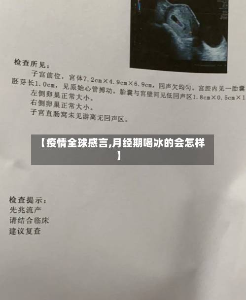 【疫情全球感言,月经期喝冰的会怎样】-第2张图片